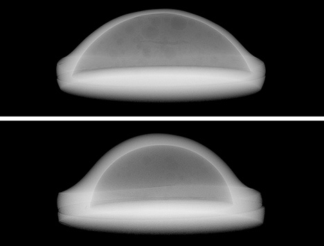 Micrografías de rayos X de dos muestras de mabe de Mayotte.